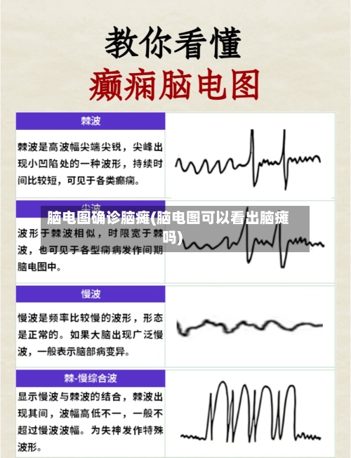 脑电图确诊脑瘫(脑电图可以看出脑瘫吗)
