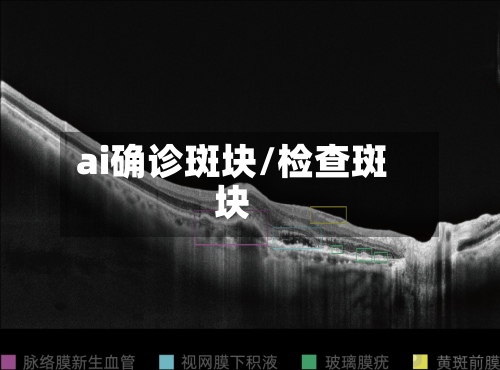 ai确诊斑块/检查斑块-第2张图片