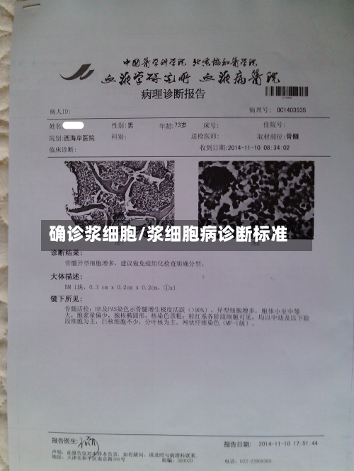 确诊浆细胞/浆细胞病诊断标准-第3张图片