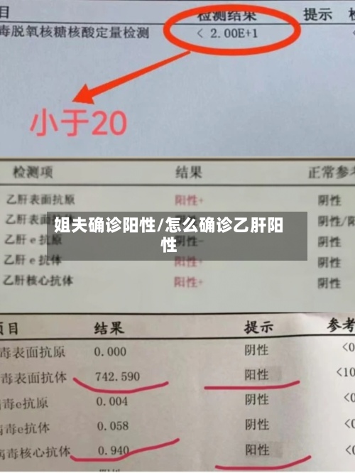 姐夫确诊阳性/怎么确诊乙肝阳性-第3张图片