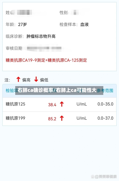 右肺ca确诊概率/右肺上ca可能性大