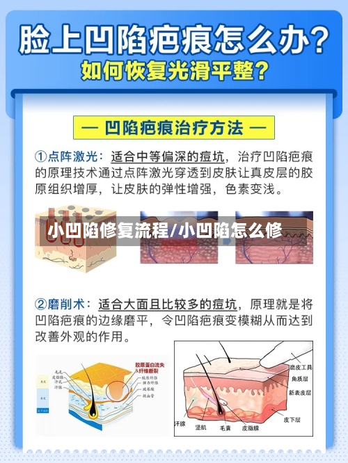 小凹陷修复流程/小凹陷怎么修-第2张图片