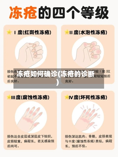 冻疮如何确诊(冻疮的诊断)