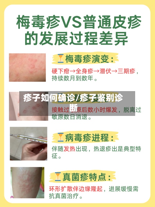 疹子如何确诊/疹子鉴别诊断-第2张图片