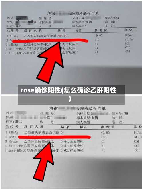 rose确诊阳性(怎么确诊乙肝阳性)-第2张图片