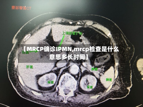 【MRCP确诊IPMN,mrcp检查是什么意思多长时间】