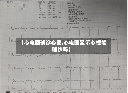 【心电图确诊心梗,心电图显示心梗能确诊吗】