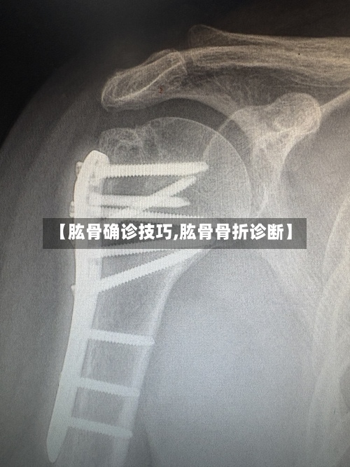 【肱骨确诊技巧,肱骨骨折诊断】-第3张图片