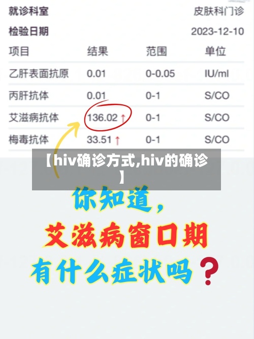 【hiv确诊方式,hiv的确诊】-第2张图片