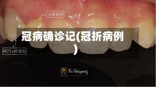 冠病确诊记(冠折病例)-第3张图片