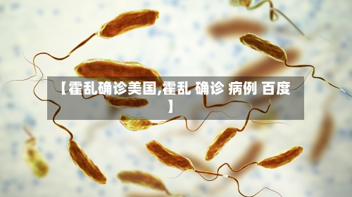 【霍乱确诊美国,霍乱 确诊 病例 百度】