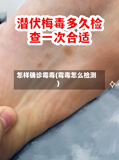 怎样确诊霉毒(霉毒怎么检测)-第2张图片